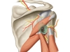 PostQuadSpaceGlenoidLabrCyst